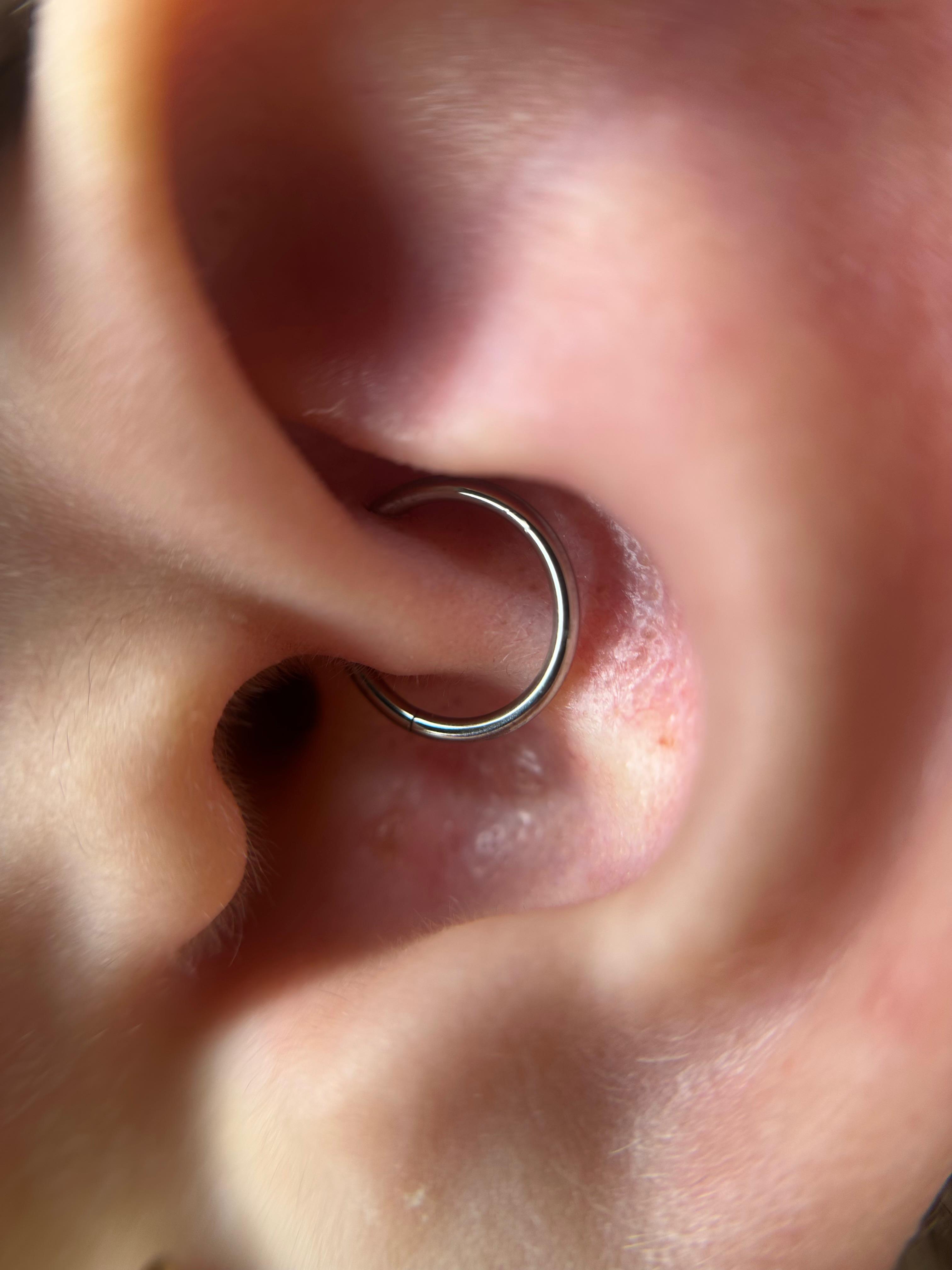 Daith piercing